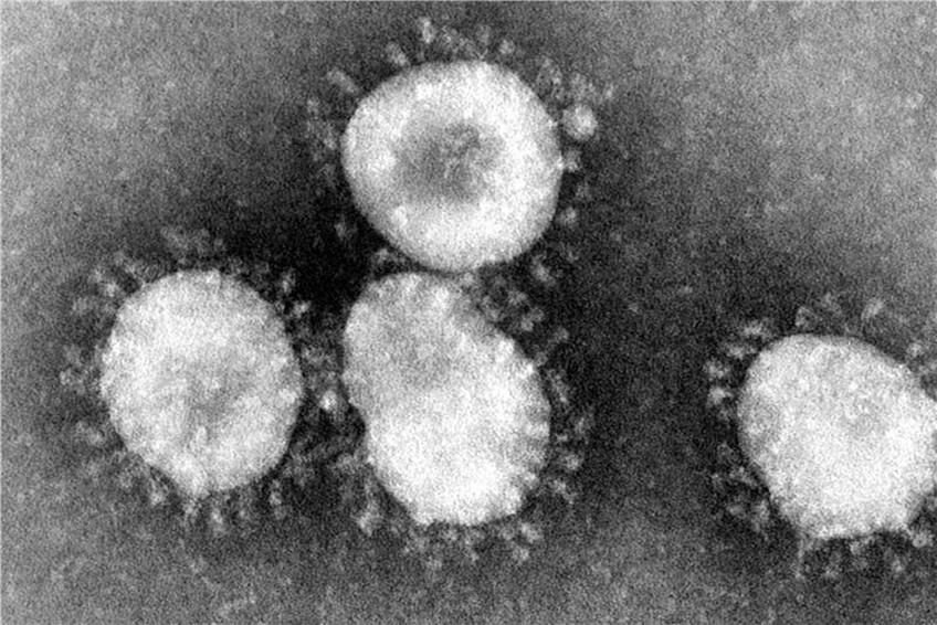Coronaviren unter dem Mikroskop. Foto: Center for Disease Control/epa/dpa/Archivbild