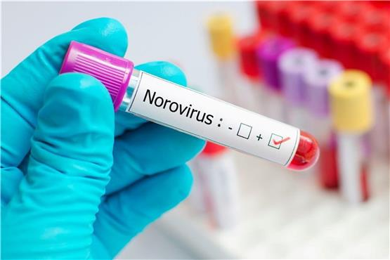 Das Norovirus verursacht bei den Betroffenen ein starkes Krankheitsgefühl und ist hochgradig ansteckend. © Foto: Jarun Ontakrai | Jarun Ontakrai/shutterstock.com