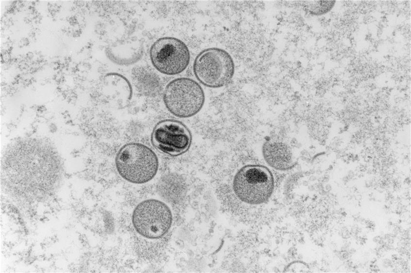 Eine elektronenmikroskopische Aufnahme von Affenpocken-Viren. Foto: Freya Kaulbars/RKI/dpa/Archivbild